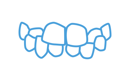 treatable cases_SS_treatable cases_crossbite