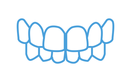 treatable cases_SS_treatable cases_overbite