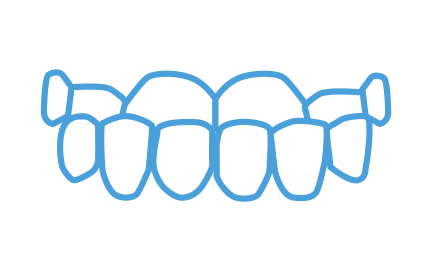 treatable cases_SS_treatable cases_underbite